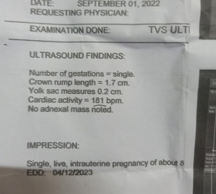 Buntis po ako kaso parang di lumalaki tiyan ko po ...
