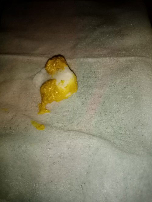 Normal ba pops ni baby