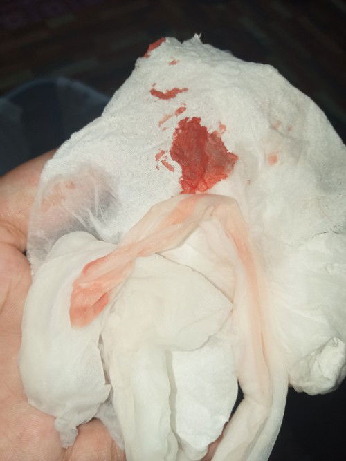 ตั้งครรภ์36วีค มีเลือดไหลออกมาไม่ปนมูกไม่ปวดท้องรู้สึกหน่วงๆเข้าห้องน้ำบ่อย ควรไปหาหมอมั้ยคะ