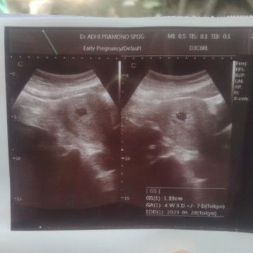 Hpht 26 juli tapi flek