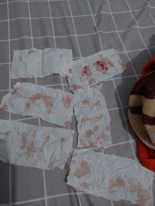 Flek trimester 1 di usia 9 w