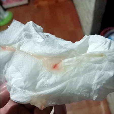 Tanong ko lang 37weeks na po ako 3cm na po daw ako may lumabas sakin kanina umaga