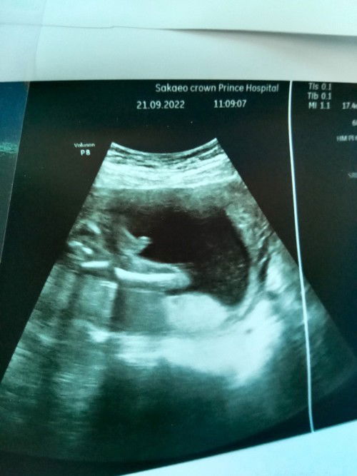 ทีมกุมภาพันธ์👶❤️