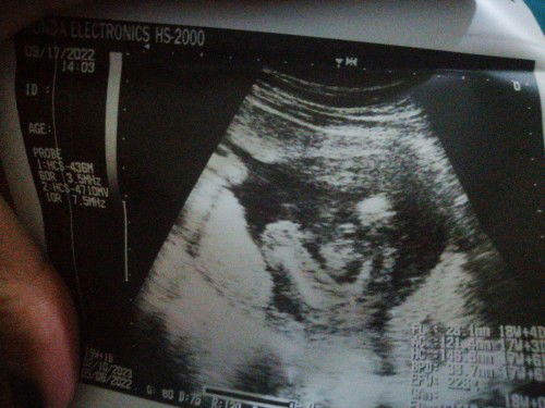 ano po kayang gender ni baby tia 😊