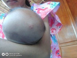 Ini kepala anak saya knp ya kayak ada bintik-bintik putih Bun?