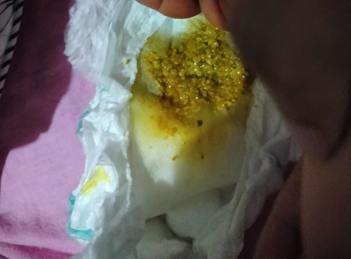 Normal ba ang poop ni baby?