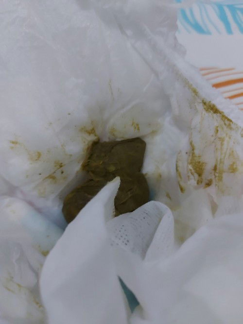 KAPAG GANITO PUPU NI BABY