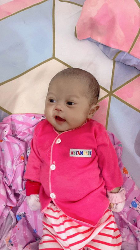 Imunisasi bcg setelah sakit pneumonia dan bb sekarang 3,5