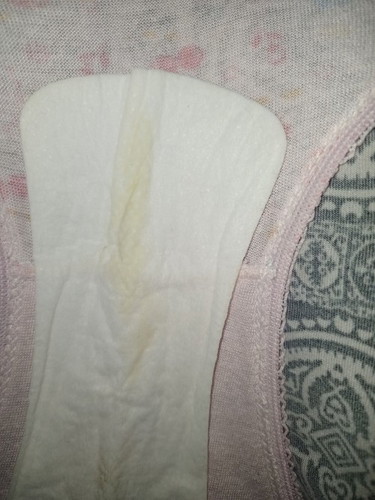 vaginal discharge
