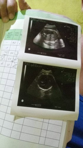 hallo bunda ,apakah arti EDD yg tertera d USG itu bs d pastikan saya akn melahirkan?