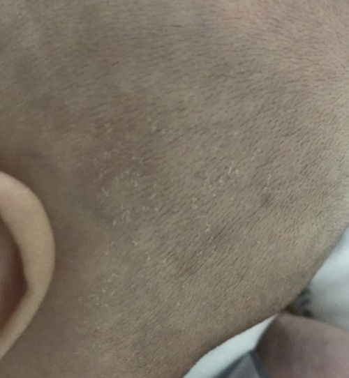 kulit kepala bayi 3 bulan