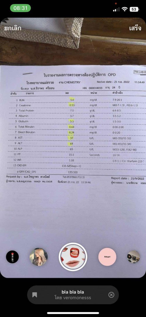 ค่าตับสูงเกิดจากอะไร