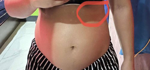 อาการคล้ายๆตะคริว