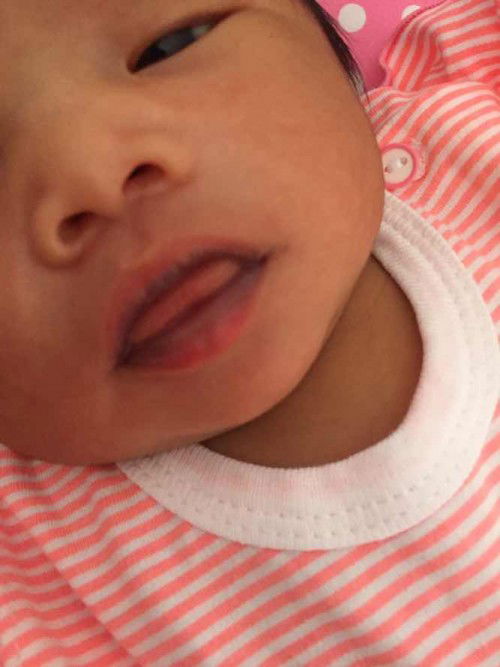 Bibir bayi warna ungu