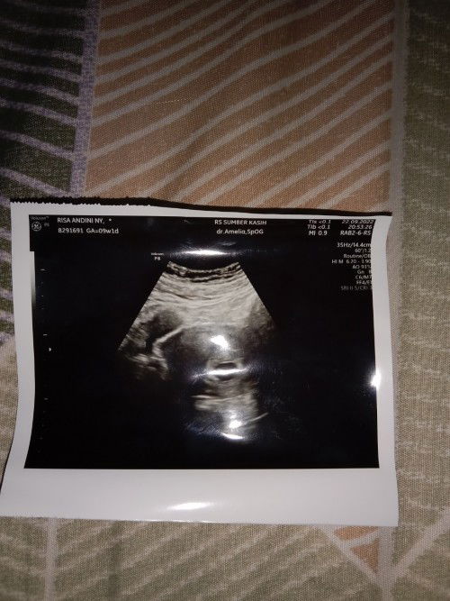 Bun minta sarannya, soalnya ini kehamilan pertama 🙏 butuh afirmasi positif..