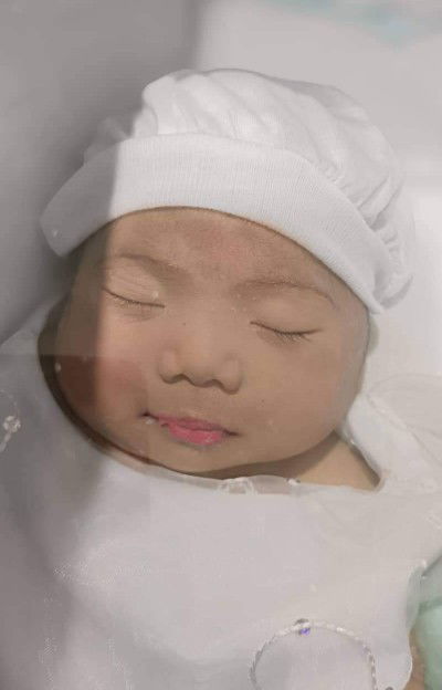 Hypoplastic Left Heart Syndrome