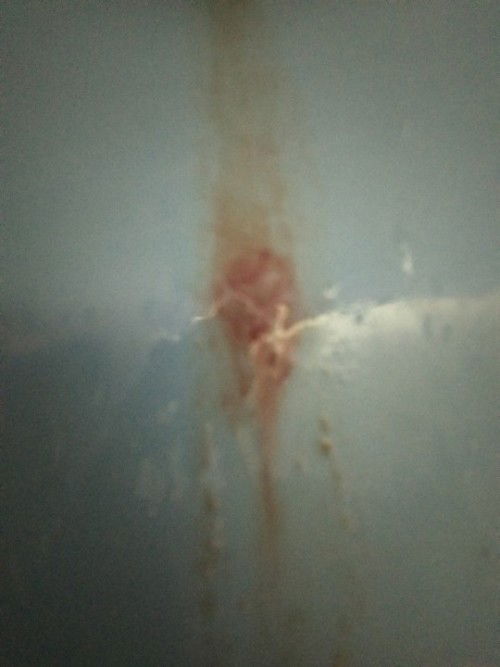 ยากทามเเม่ๆ