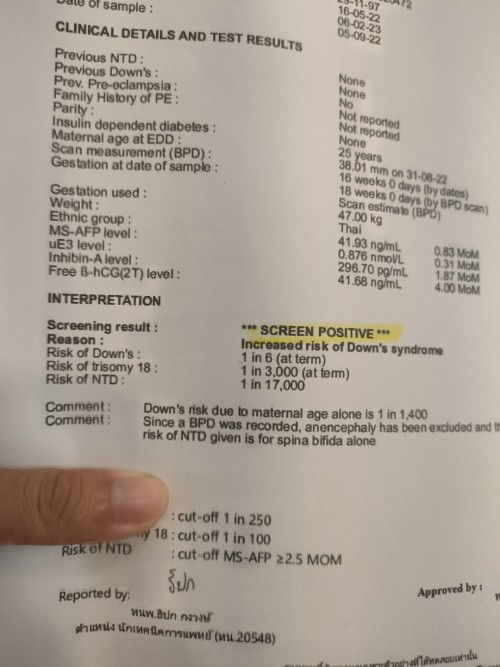 เสี่ยงดาวซินโดรม