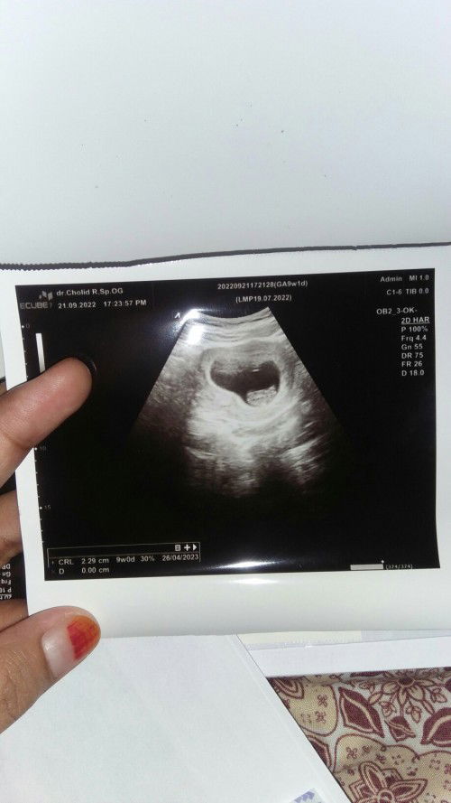 Hamil 9 minggu