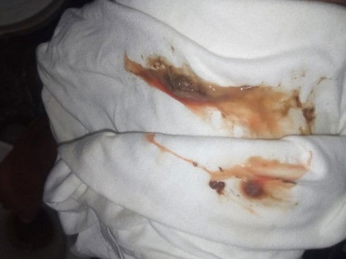 38w4d still 1cm (EDD: OCT.2)