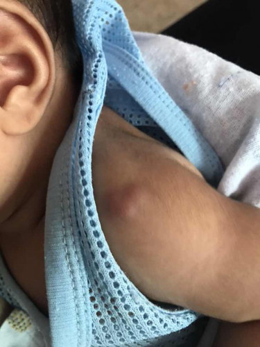 วัคซีนแรกเกิด