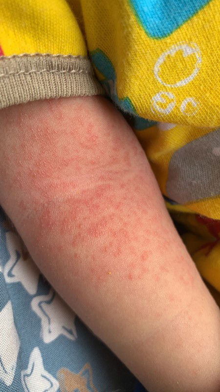 Bantu jawab dong bund