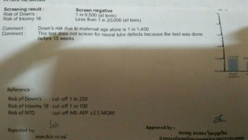 ผลตรวจดาวน์ซินโดรม