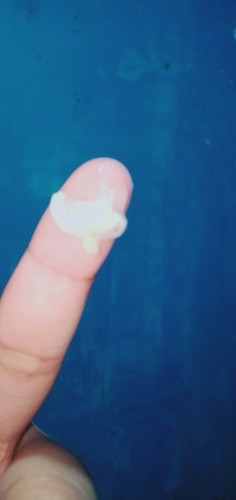 pag po ba nilabasan na ng ganyn. derederetso na po ba ng labor. mag 1cm plang dw po aq eh.