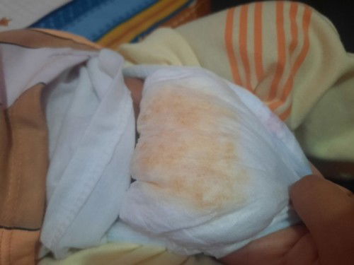 Warna pipis bayi (CLOSED)