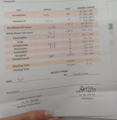 Ask lang mga mii