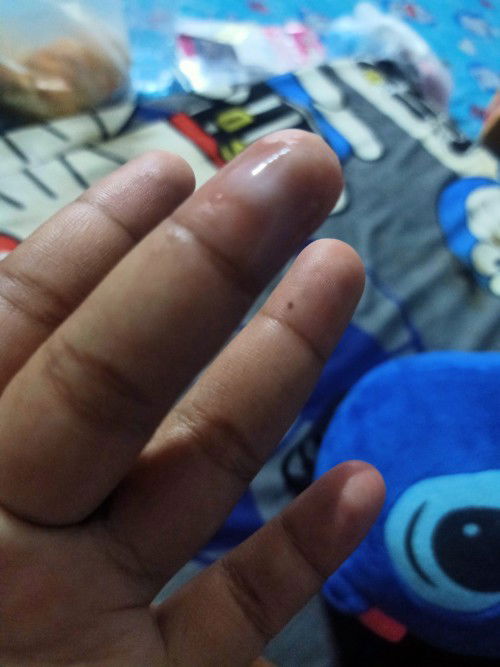 แม่ๆค่ะสอบถามหน่อยค่ะนี่คือตกขาวรึว่ามูก ท้องแรกค่ะ 34+3วีค