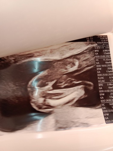 เพศลูก ญรึช น๊า แม่ๆคนไหนดูออกไหมคะ