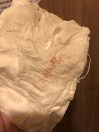 Spotting after 2 weeks delaeyed period