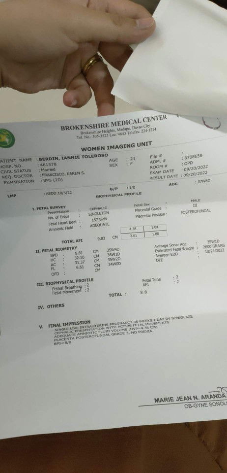 Ang tagal ko mag labor