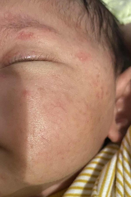 apakah bayi tidak cocok sufor ?