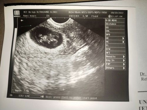 Mababa po si baby or hindi?