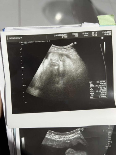 ตั้งครรภ์37 week