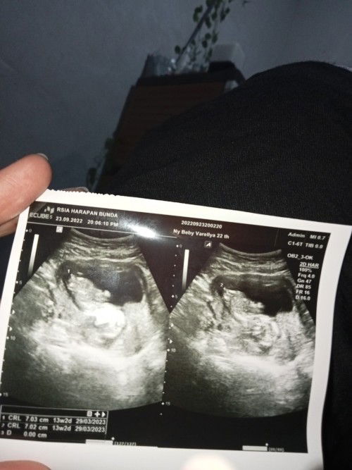 mau nanya yg bisa baca hasil usg dong