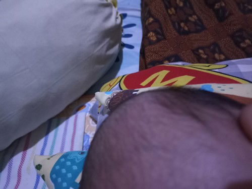 Rambut baby new born rontok