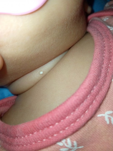 Hello mamies first time mommy po ako .normal lang po ba to sa may leeg niga na kulay puti simula pa