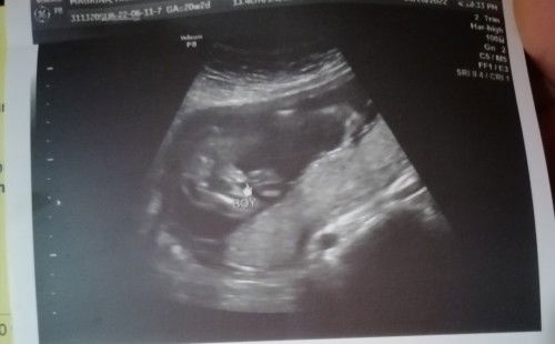 Baby Boy o Baby Girl?