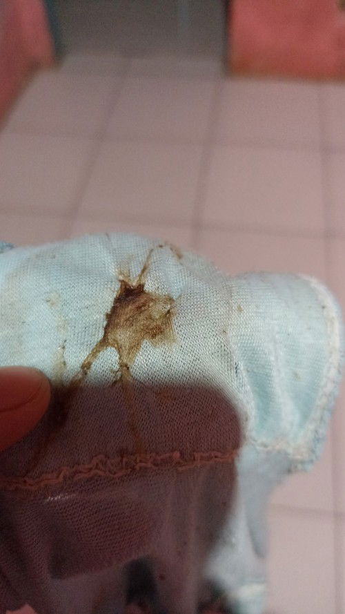 Keluar lendir bercampur darah 3 hari berturut-turut tapi tidak merasakan mules,