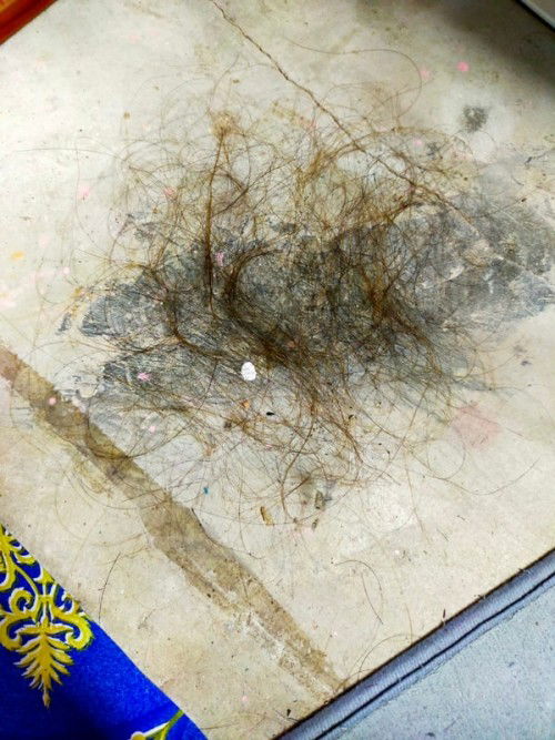 ปัญหาหลังคลอด