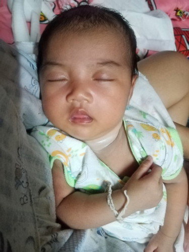 ลูกแหวะนม