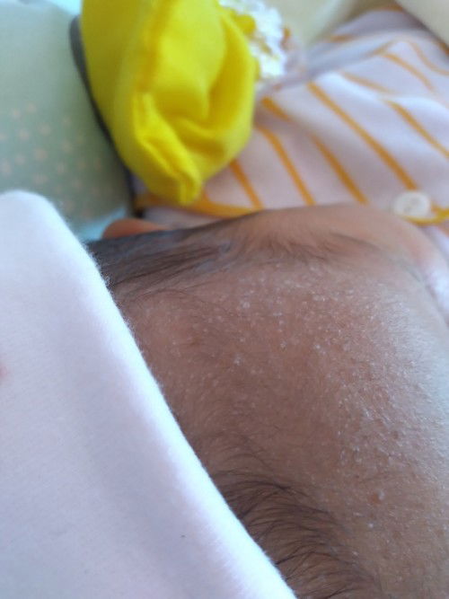 di bagian kepala depan ada seperti bruntus kenapa ya bund ?