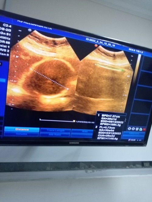 Gambar ini USG yg berapa dimensi ya