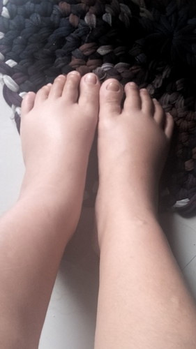 แม่ๆท่านไหนเป็นแบบนี้บ้างคะท้อง 39 + 3มดลูกเปิด 3.5 cm แต่หมอให้กลับบ้านเพราะยังไม่มีน้ำเดินไม่มีมูก