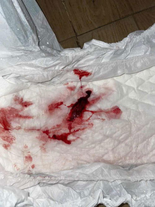 5 minggu (keguguran)