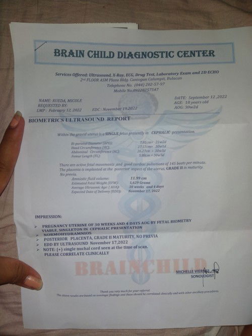 Nakapanganak kana ba na nakapalupot Ang single cord ni baby?