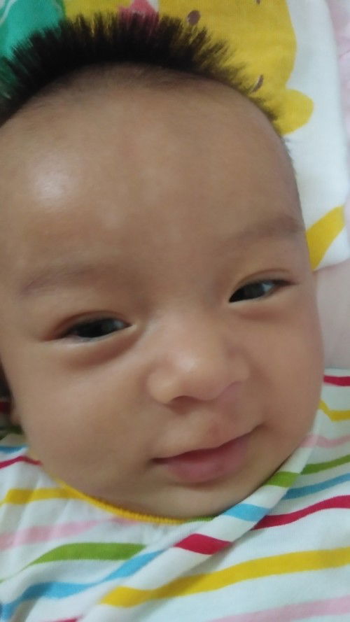 หน้าผากลูกน้อย